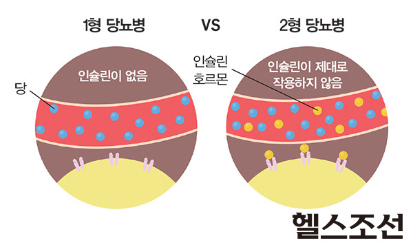 당뇨의 원인과 증상 및 관리하는 방법, 당뇨에 필요한 영양소