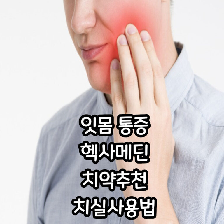 잇몸이 부음, 약국에서 헥사메딘 구매(치약 추천, 치실사용법)